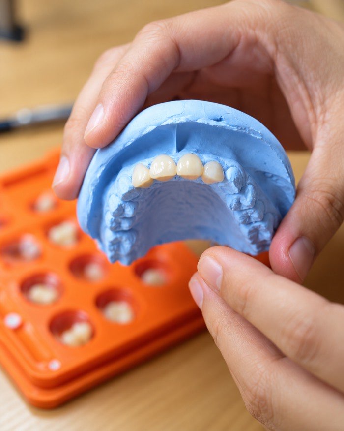 A technician hand-finishing a dental restoration and 3D-printing a denture in our in-house laboratory